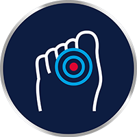 Viszket és ég a lábujjai közötti terület?