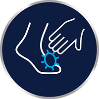 A gombás bőrfertőzés közvetlenül bőrről bőrre könnyen terjed