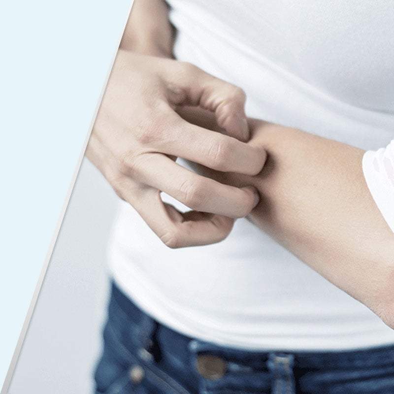 A test felületes gombás bőrfertőzésének tünetei