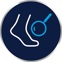 Mindennap vizsgálja meg alaposan a lábát, ne hagyja ki a lábujjak közötti területet se